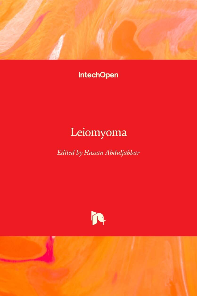 Leiomyoma