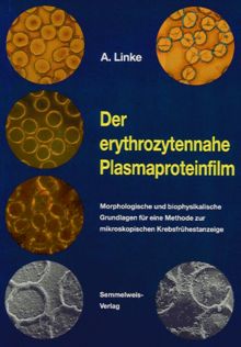 Der erythrozytennahe Plasmaproteinfilm. Morphologische und biophysikalische Grundlagen für eine Methode zur mikroskopischen Krebsfrühestanzeige