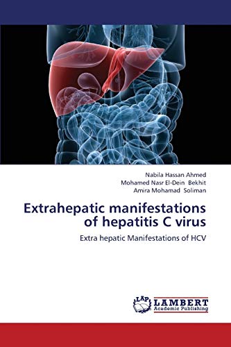Extrahepatic manifestations of hepatitis C virus: Extra hepatic Manifestations of HCV