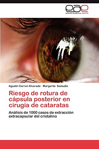 Riesgo de rotura de cápsula posterior en cirugía de cataratas: Análisis de 1000 casos de extracción extracapsular del cristalino