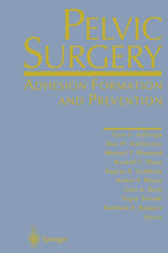 Pelvic Surgery: Adhesion Formation and Prevention
