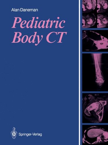 Pediatric Body Ct