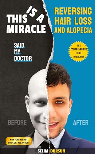 THIS IS A MIRACLE SAID MY DOCTOR: REVERSING HAIR LOSS AND ALOPECIA
