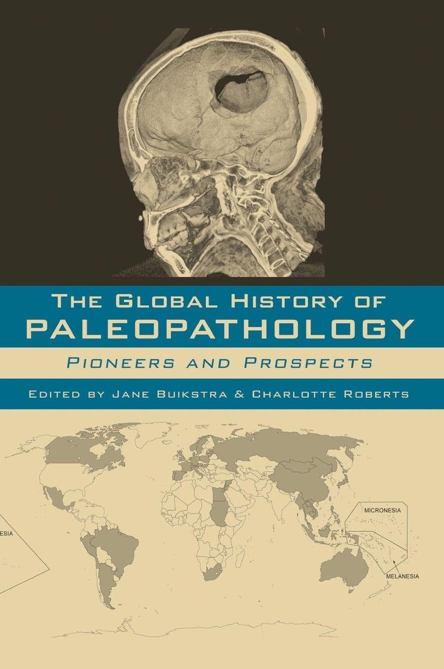 The Global History of Paleopathology: Pioneers and Prospects