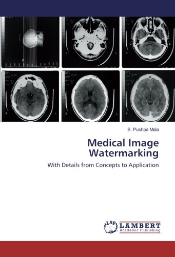 Medical Image Watermarking: With Details from Concepts to Application