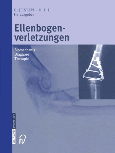 Ellenbogenverletzungen: Biomechanik Diagnose Therapie (German Edition)