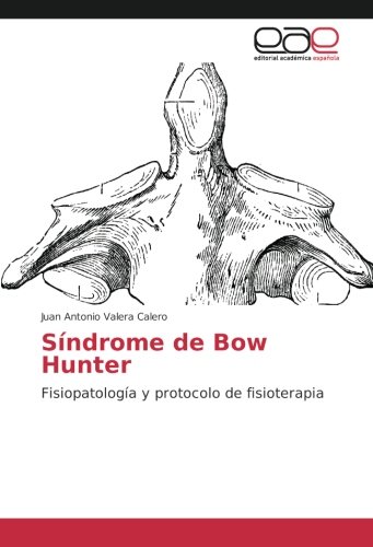 Síndrome de Bow Hunter: Fisiopatología y protocolo de fisioterapia