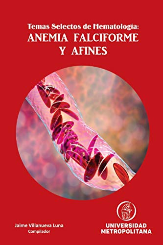 Temas Selectos de Hematología: ANEMIA FALCIFORME Y AFINES