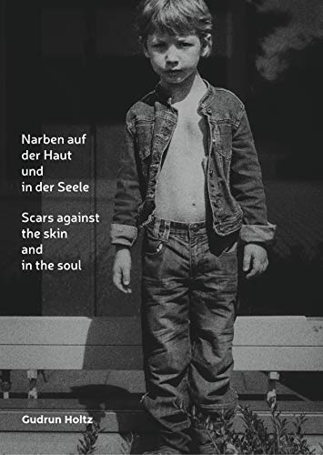 Narben auf der Haut und in der Seele: Scars against the skin and the soul