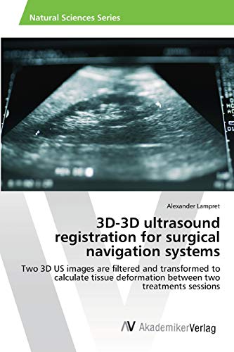 3D-3D ultrasound registration for surgical navigation systems: Two 3D US images are filtered and transformed to calculate tissue deformation between two treatments sessions