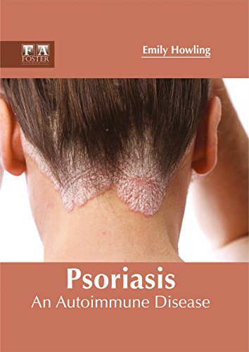 Emily Howling Psoriasis, An Autoimmune Disease