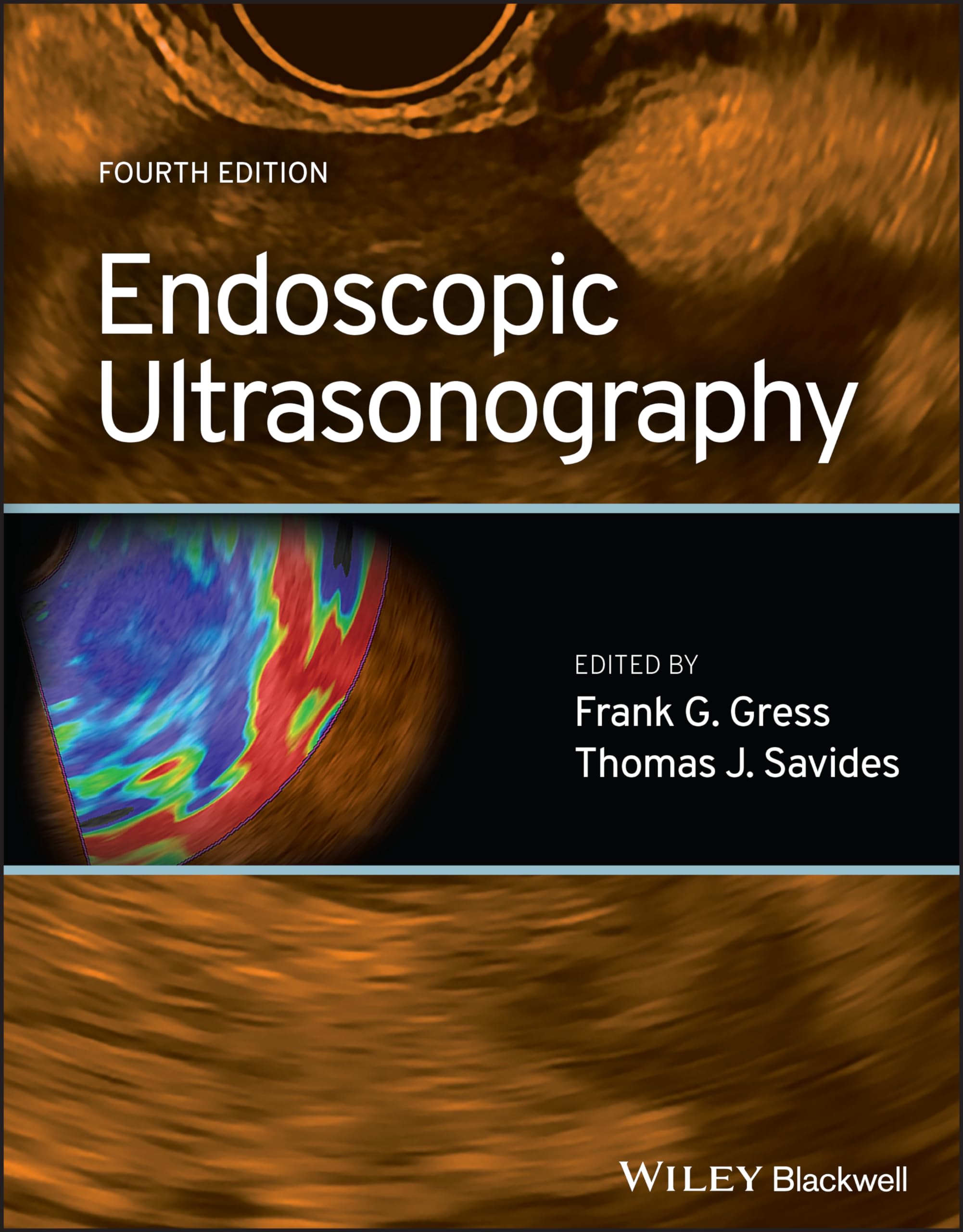 Endoscopic Ultrasonography - Neuware
