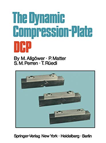 The Dynamic Compression Plate (DCP)