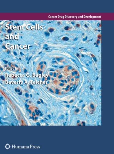 Stem Cells and Cancer (Cancer Drug Discovery and Development)