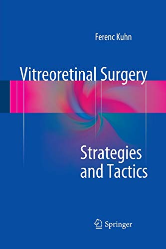 Vitreoretinal Surgery: Strategies and Tactics