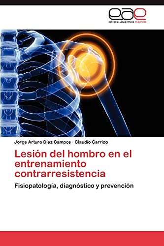 Lesión del hombro en el entrenamiento contrarresistencia: Fisiopatología, diagnóstico y prevención
