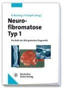 Neurofibromatose Typ 1: Die Rolle der bildgebenden Diagnostik