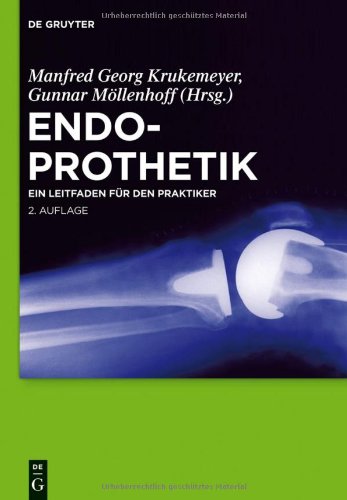 Endoprothetik: Leitfäden für Praktiker
