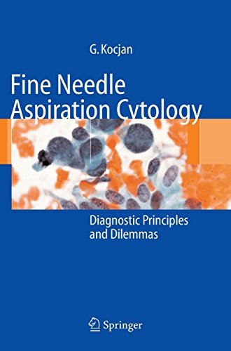 Fine Needle Aspiration Cytology: Diagnostic Principles and Dilemmas