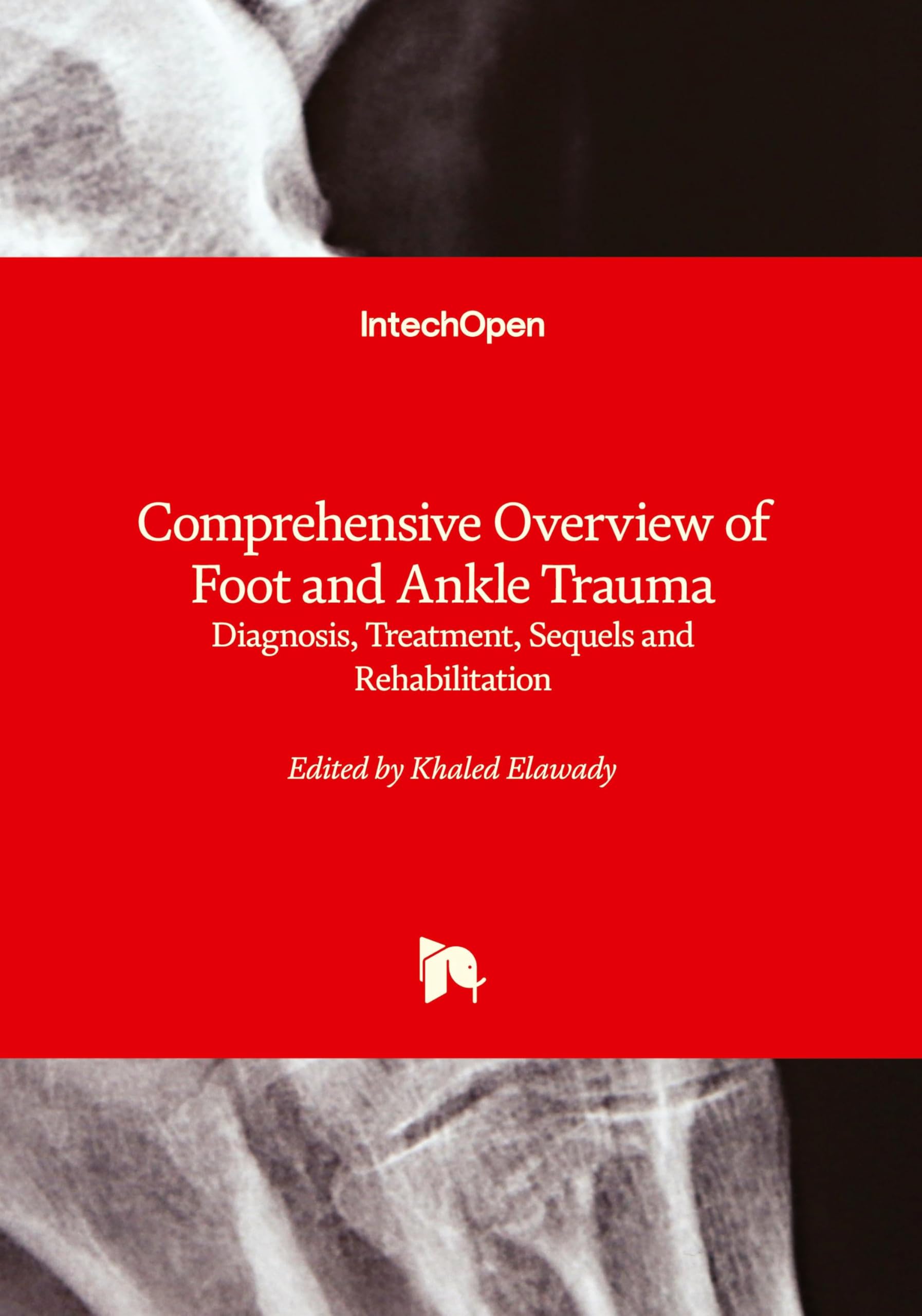 Comprehensive Overview of Foot and Ankle Trauma - Diagnosis, Treatment, Sequels and Rehabilitation: Diagnosis, Treatment, Sequels and Rehabilitation