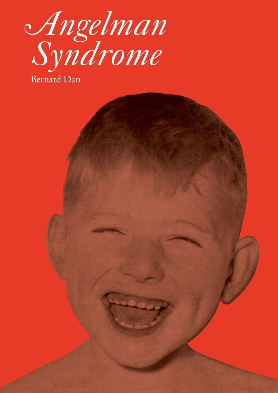 Angelman Syndrome (Clinics in Developmental Medicine)
