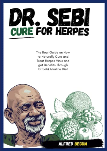 Alfred Begum Dr. Sebi Cure For Herpes. The Real Guide On How To Naturally Cure And Treat Herpes Virus And Get Benefits Through Dr. Sebi Alkaline Diet