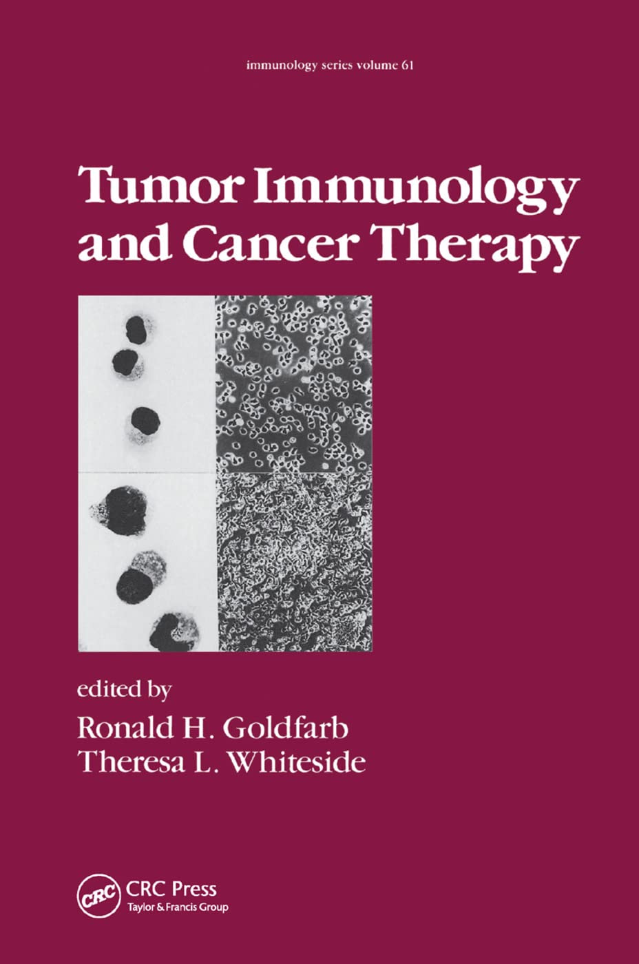 Tumor Immunology and Cancer Therapy (Immunology, 61, Band 61)