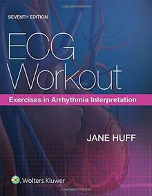 ECG Workout: Exercises in Arrhythmia Interpretation