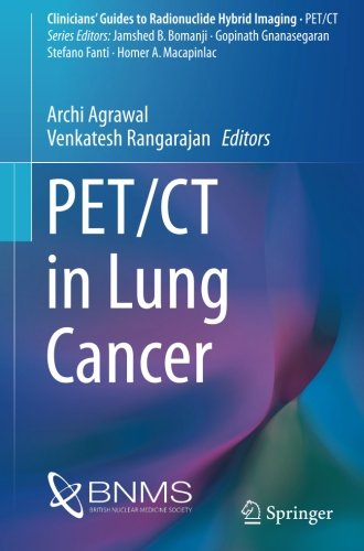 PET/CT in Lung Cancer (Clinicians’ Guides to Radionuclide Hybrid Imaging)