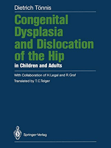 Congenital Dysplasia and Dislocation of the Hip in Children and Adults