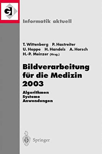 Bildverarbeitung für die Medizin 2003: Algorithmen - Systeme - Anwendungen, Proceedings Des Workshops Vom 9.11. März 2003 In Erlangen: Algorithmen, ... Marz 2003 in Erlangen (Informatik aktuell)