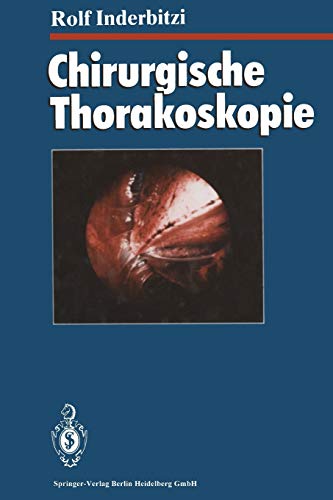Chirurgische Thorakoskopie (German Edition)