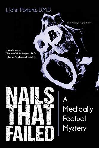Nails That Failed: A Medically Factual Mystery