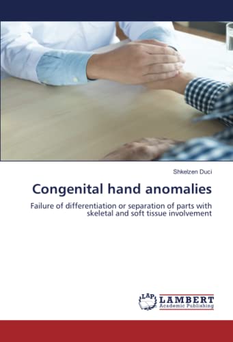 Congenital hand anomalies: Failure of differentiation or separation of parts with skeletal and soft tissue involvement