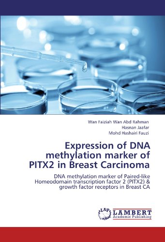 Expression of DNA methylation marker of PITX2 in Breast Carcinoma: DNA methylation marker of Paired-like Homeodomain transcription factor 2 (PITX2) & growth factor receptors in Breast CA