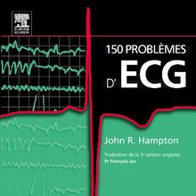 150 problèmes d'ECG