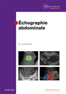 Echographie abdominale