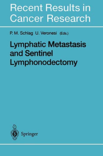 Lymphatic Metastasis and Sentinel Lymphonodectomy (Recent Results in Cancer Research, 157, Band 157)