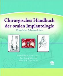 Chirurgisches Handbuch der oralen Implantologie: Praktische Arbeitsschritte