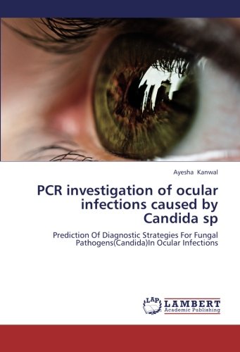 PCR investigation of ocular infections caused by Candida sp: Prediction Of Diagnostic Strategies For Fungal Pathogens(Candida)In Ocular Infections