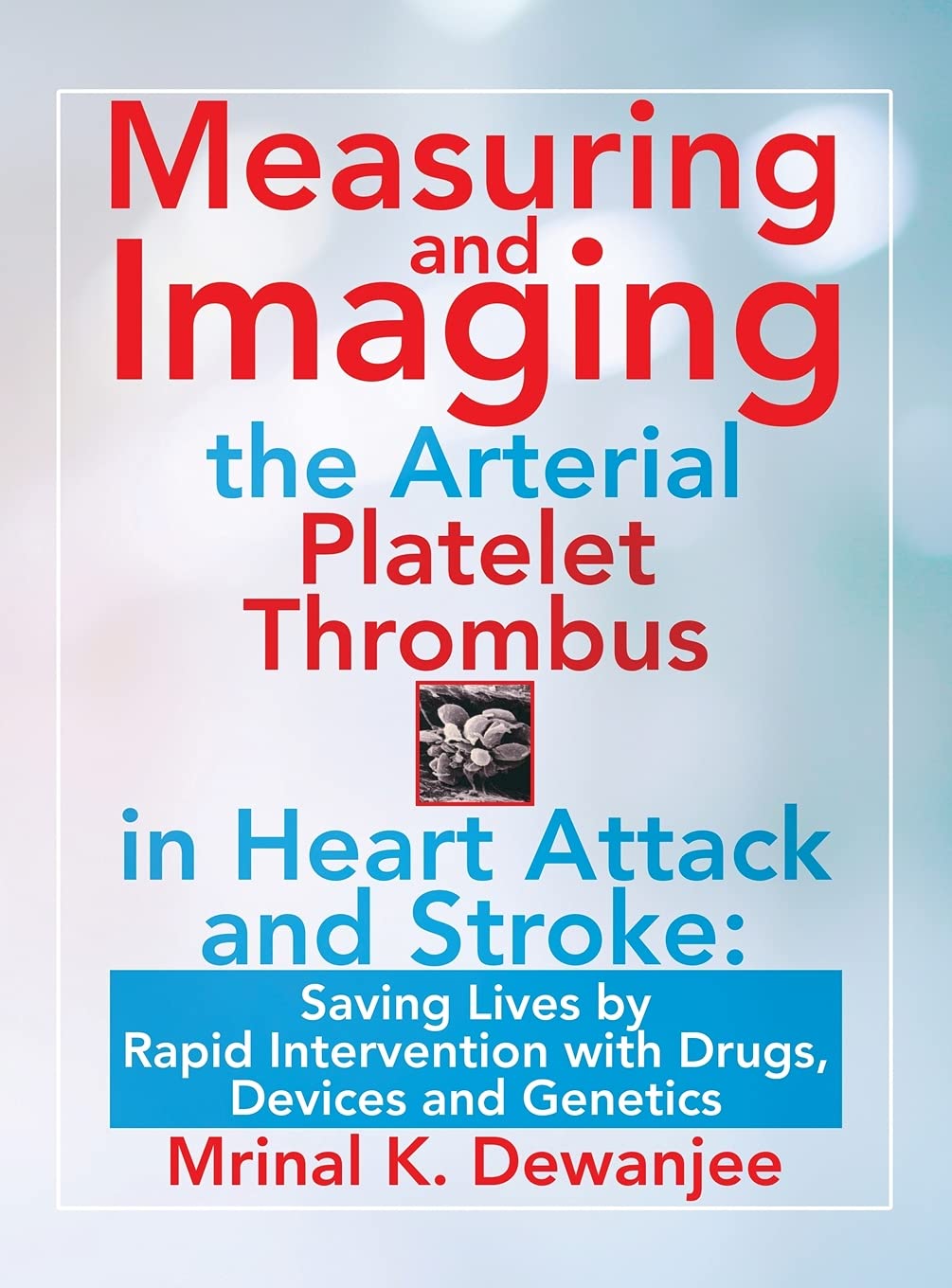 Measuring and Imaging the Arterial Platelet Thrombus in Heart Attack and Stroke: : Saving Lives by Rapid Intervention with Drugs, Devices and Genetics