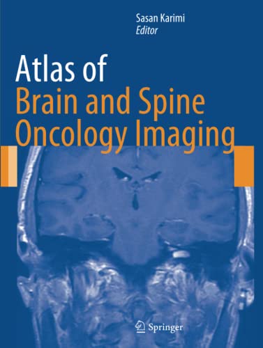 Atlas of Brain and Spine Oncology Imaging (Atlas of Oncology Imaging)