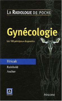 Gynécologie : les 100 principaux diagnostics