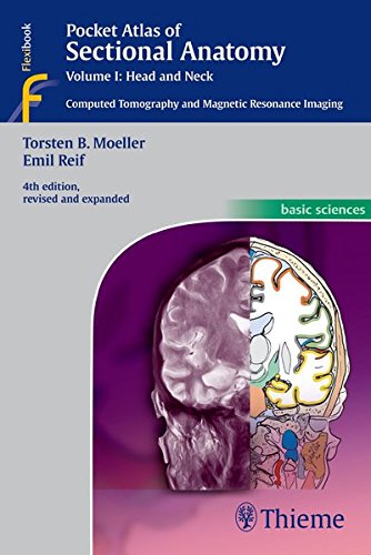 Möller, Torsten Bert Pocket Atlas Of Sectional Anatomy, Volume I, Head And Neck, Computed Tomography And Magnetic Resonance Imaging (Basic Sciences (Thieme))