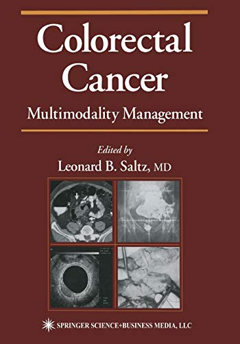 Colorectal Cancer: Multimodality Management (Current Clinical Oncology)