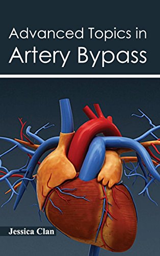 Advanced Topics in Artery Bypass