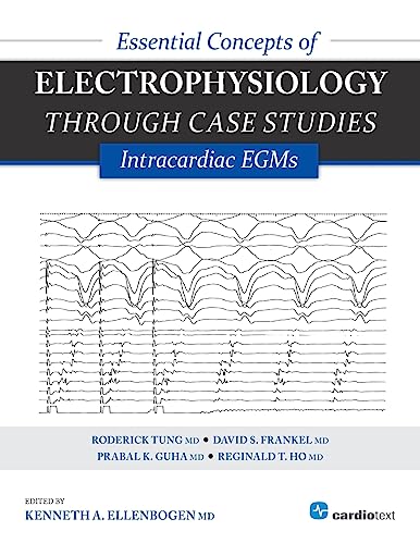 Essential Concepts of Electrophysiology Through Case Studies: Intracardiac EGMs: Intracardiac EGMs: Intracardiac EGMs
