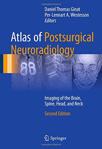 Atlas of Postsurgical Neuroradiology: Imaging of the Brain, Spine, Head, and Neck