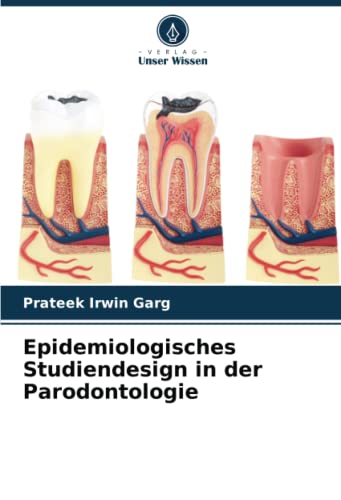 Epidemiologisches Studiendesign in der Parodontologie