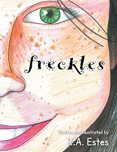 Freckles